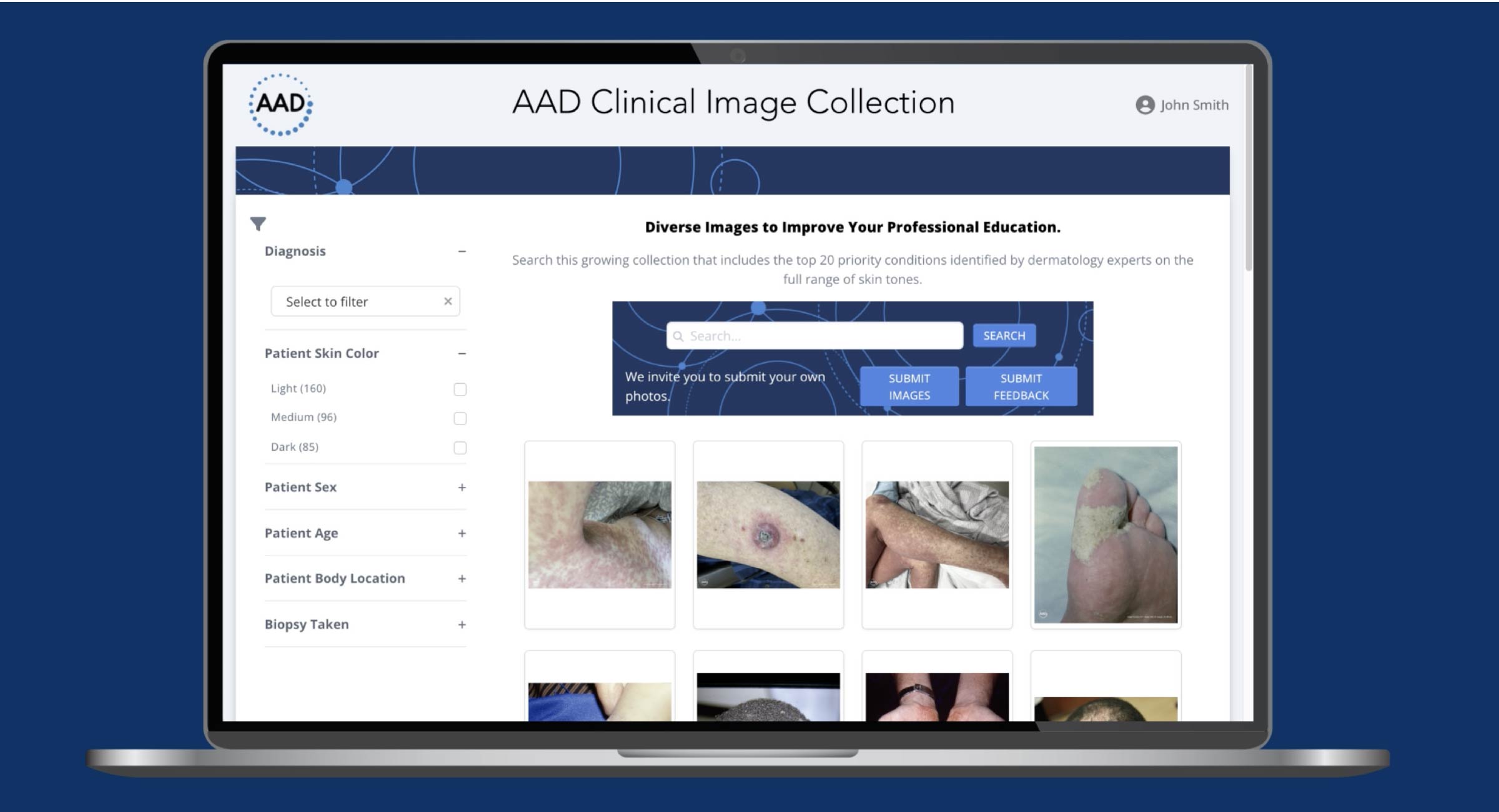 Representation of the AAD Clinical Image Collection on a laptop